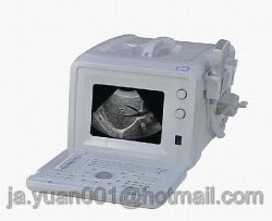 Exrh-300a Portable Ultrasound Scanne