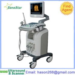  Ss-500 Ultrasound B Scanner(3d Function Optional)