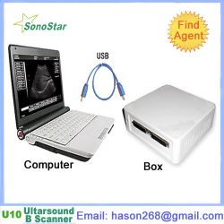 Ubox-10 Ultrasound B Scanner Box