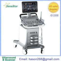 Ss-2200 Color Doppler System