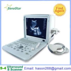  Ss-4 Ultrasound Diagnosis B Scanner