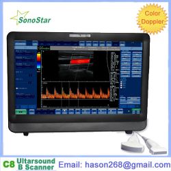 C8 Color Doppler Ultrasound System(