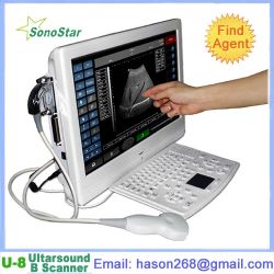  Utouch-8 Touch Screen Lcd Ultrasound Scanner