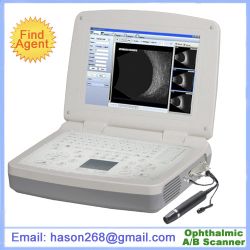Sab-500 Ophthalmic A/b Scanner