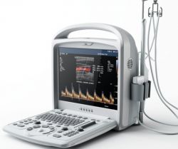 Nh-600 Portable Color Ultrasound Machine